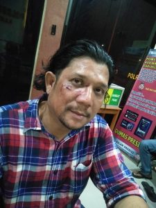 SMSI Sumut Minta Poldasu Tangkap Pelaku Penganiayaan Ketua SMSI Madina