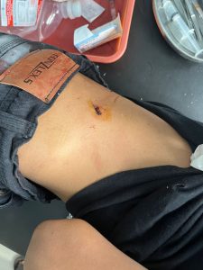 Ribut Soal Perempuan, Remaja Lebong Ditusuk Pelajar Bengkulu Utara